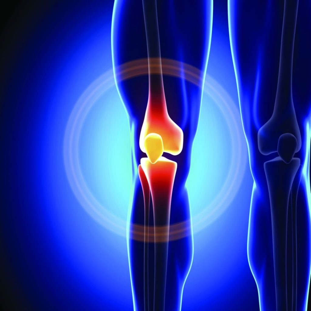 revision knee replacement 1